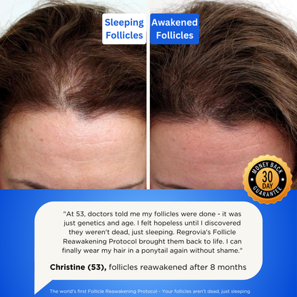 Regrovia Naturals Roller™